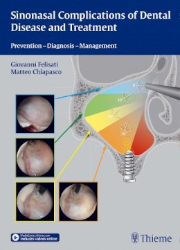 . Ed(S): Felisati, Giovanni; Chiapsco, Matteo - Sinonasal Complications of Dental Disease and Treatment - 9783131997012 - V9783131997012