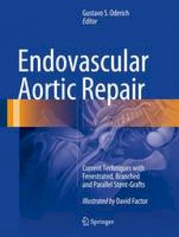 Gustavo S. Oderich (Ed.) - Endovascular Aortic Repair: Current Techniques with Fenestrated, Branched and Parallel Stent-Grafts - 9783319151915 - V9783319151915