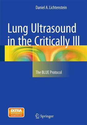 Daniel A. Lichtenstein - Lung Ultrasound in the Critically Ill: The BLUE Protocol - 9783319153704 - V9783319153704