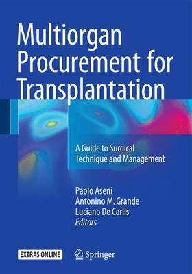 Paolo Aseni (Ed.) - Multiorgan Procurement for Transplantation - 9783319284149 - V9783319284149