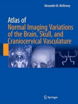 Alexander M. McKinney - Atlas of Normal Imaging Variations of the Brain, Skull, and Craniocervical Vasculature - 9783319397894 - V9783319397894