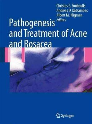 Christos C. Zouboulis (Ed.) - Pathogenesis and Treatment of Acne and Rosacea - 9783540693741 - V9783540693741