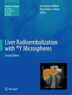 José Ignacio Bilbao (Ed.) - Liver Radioembolization with 90Y Microspheres - 9783642364723 - V9783642364723