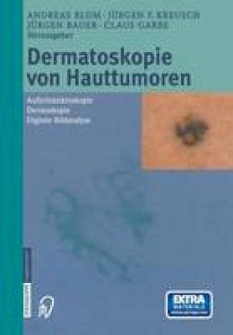 A Blum (Ed.) - Dermatoskopie von Hauttumoren: Auflichtmikroskopie  -  Dermoskopie  -  Digitale Bildanalyse (German Edition) - 9783642632686 - V9783642632686