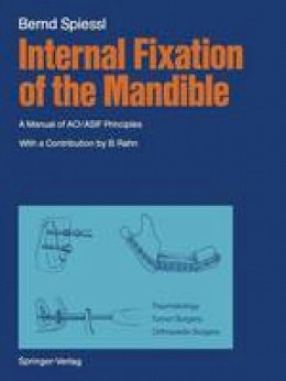 Bernd Spiessl - Internal Fixation of the Mandible - 9783642710360 - V9783642710360