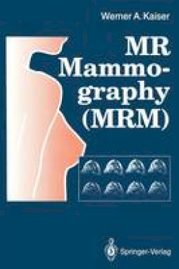 Werner A. Kaiser - M.R. Mammography (M.R.M.) - 9783642772580 - V9783642772580