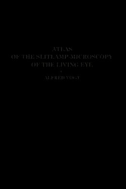 Alfred Vogt - Atlas of the Slitlamp-Microscopy of the Living Eye: Technic and Methods of Examination - 9783662245323 - V9783662245323