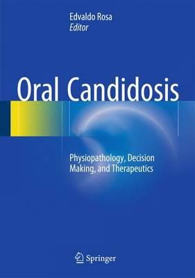 Edvaldo  Antonio Ribeiro  Rosa (Ed.) - Oral Candidosis: Physiopathology, Decision Making, and Therapeutics - 9783662471937 - V9783662471937