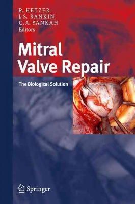 Hetzer - Mitral Valve Repair: The Biological Solution - 9783798518667 - V9783798518667