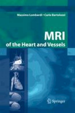 Massimo Lombardi - MRI of the Heart and Vessels - 9788847055469 - V9788847055469