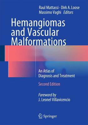 Raul Mattassi (Ed.) - Hemangiomas and Vascular Malformations: An Atlas of Diagnosis and Treatment - 9788847056725 - V9788847056725