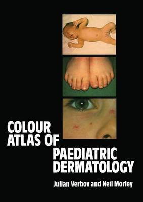 Julian Verbov - Colour Atlas of Paediatric Dermatology - 9789400973398 - V9789400973398