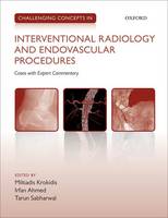 . Ed(S): Krokidis, Miltiadis; Ahmed, Irfan; Sabharwal, Tarun - Challenging Concepts in Interventional Radiology - 9780199664382 - V9780199664382