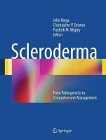 Varga  John - Scleroderma: From Pathogenesis to Comprehensive Management - 9781461490272 - V9781461490272
