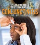Nancy Dickmann - What You Need to Know about Conjunctivitis - 9781474711913 - V9781474711913