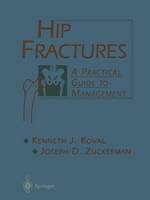 Kenneth J. Koval - Hip Fractures: A Practical Guide to Management - 9781475740547 - V9781475740547