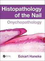 Eckart Haneke - Histopathology of the Nail: Onychopathology - 9781482212327 - V9781482212327