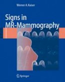 Werner A. Kaiser - Signs in MR-Mammography - 9783642092336 - V9783642092336