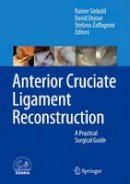 Rainer Siebold (Ed.) - Anterior Cruciate Ligament Reconstruction: A Practical Surgical Guide - 9783642453489 - V9783642453489