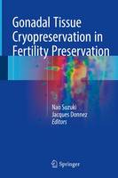 Jacques Donnez (Ed.) - Gonadal Tissue Cryopreservation in Fertility Preservation - 9784431559610 - V9784431559610