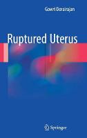 Gowri Dorairajan - Ruptured Uterus - 9789811028502 - V9789811028502